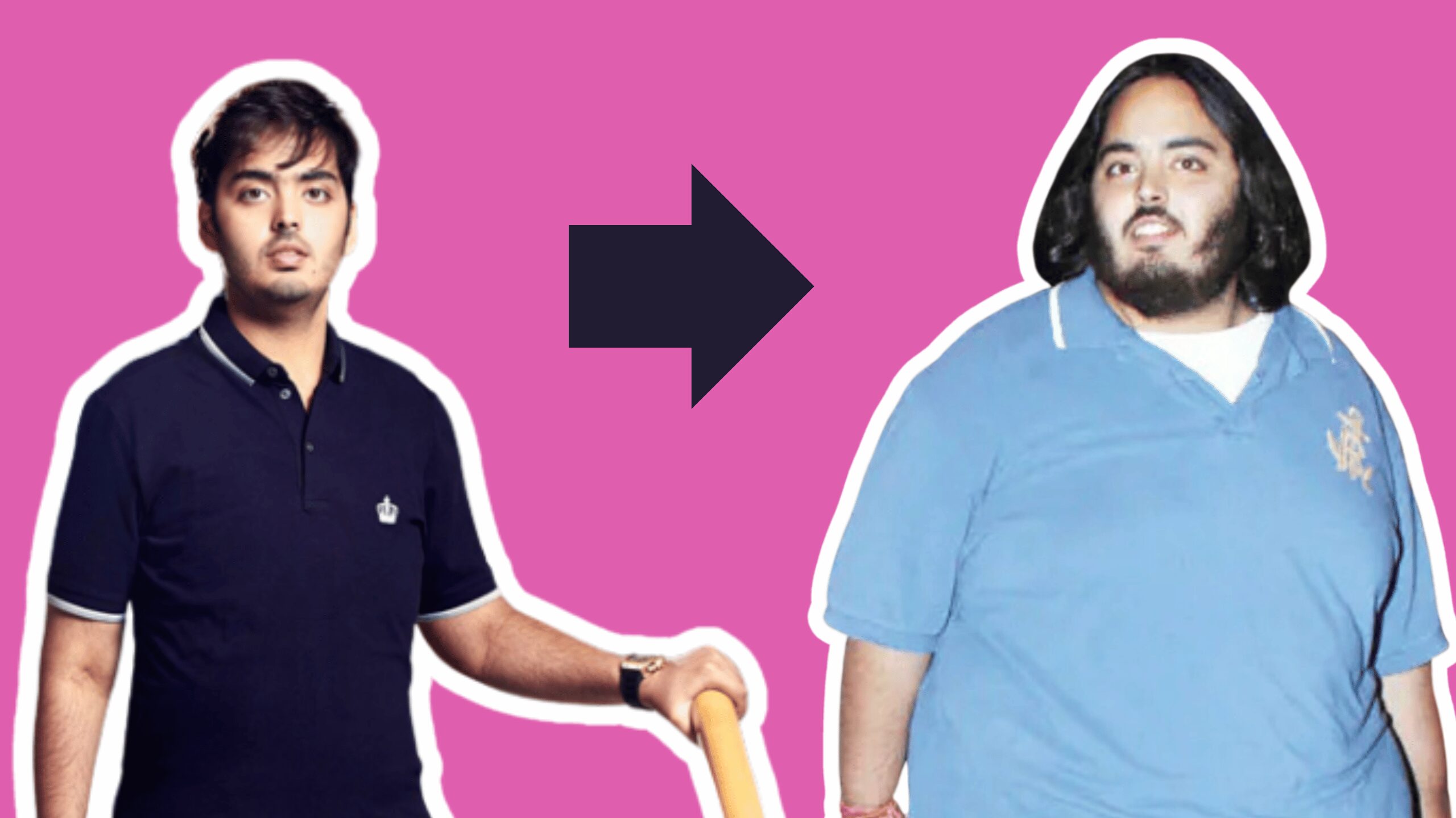 anant ambani malattia